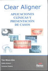 clear-aligner - Prof. Lorenzo Favero - Odontoiatria Specialistica