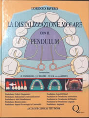 la-distalizzazione-molare - Prof. Lorenzo Favero - Odontoiatria Specialistica